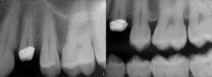 odontologia_avanzada_biomimetica_13