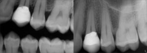 odontologia_avanzada_biomimetica_20