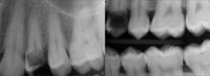 odontologia_avanzada_biomimetica_4