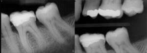 odontologia_biomimetica_18